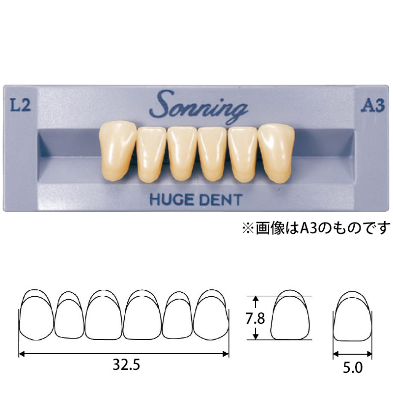 ソニア パラ前歯(硬質レジン歯) 下顎 パラ 右 A2